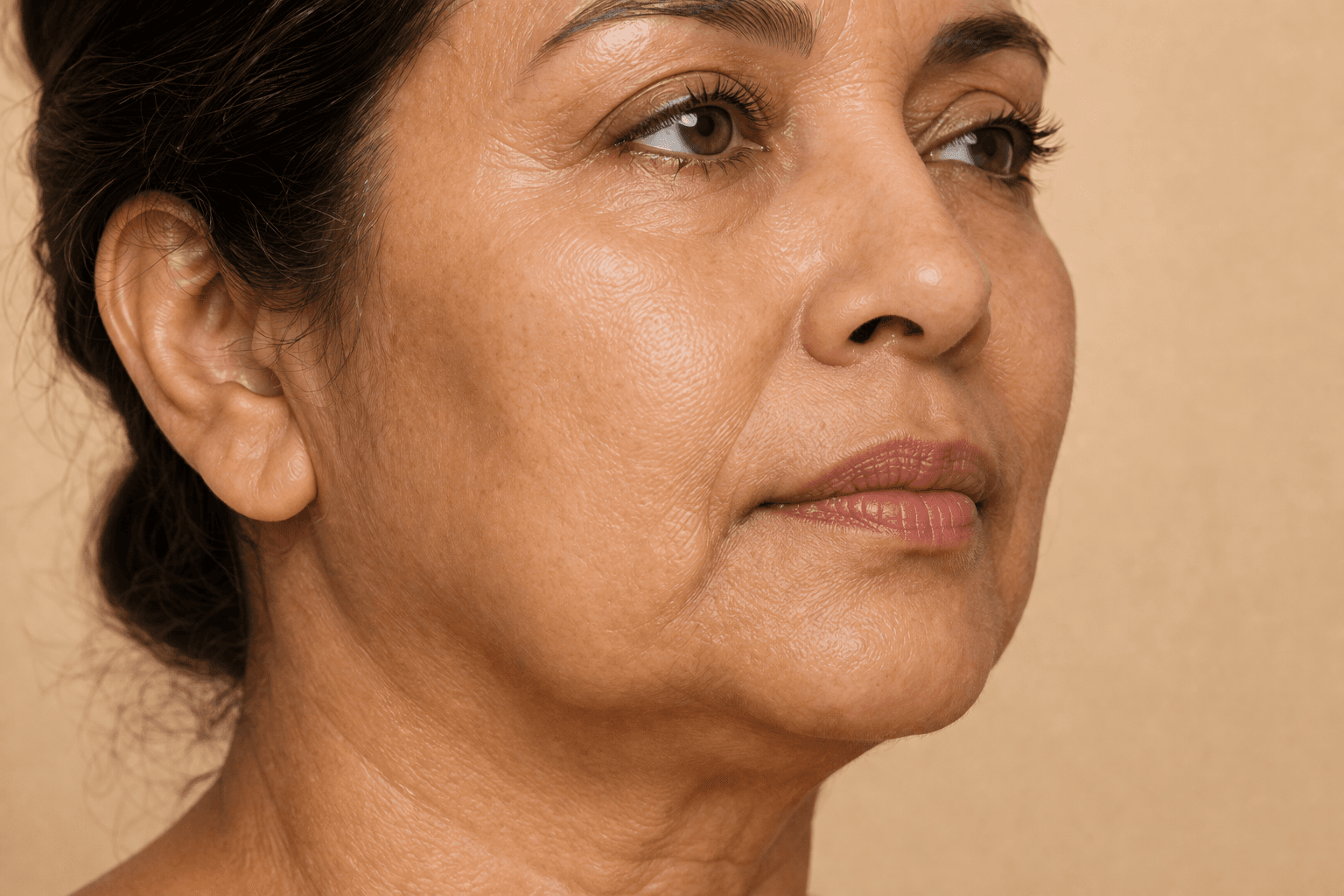 Tensado de piel y levantamiento no quirúrgico para flacidez en La Miel Aesthetics, spa médico en Raleigh, NC.